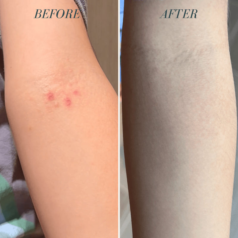 Vivaiodays Olive & Caper Rescue Balm Gel