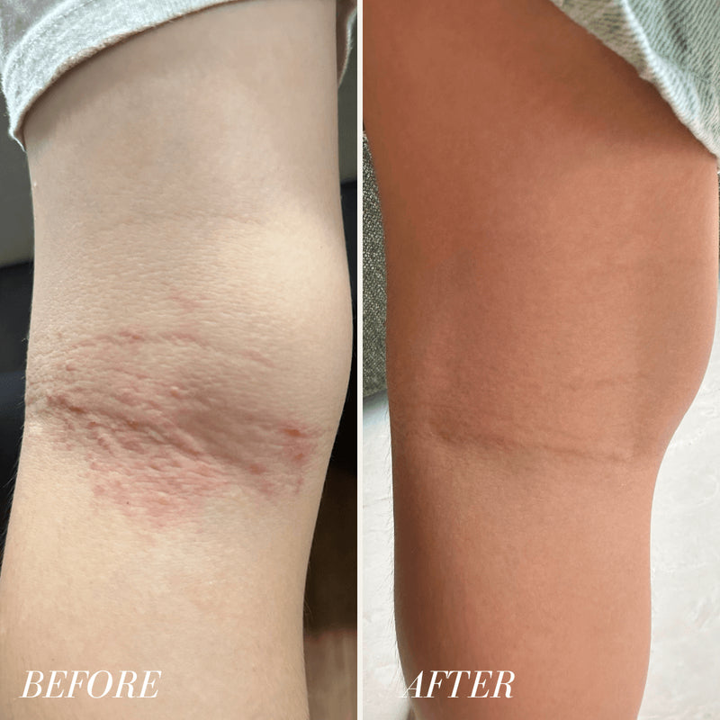 Vivaiodays Olive & Caper Rescue Balm Gel